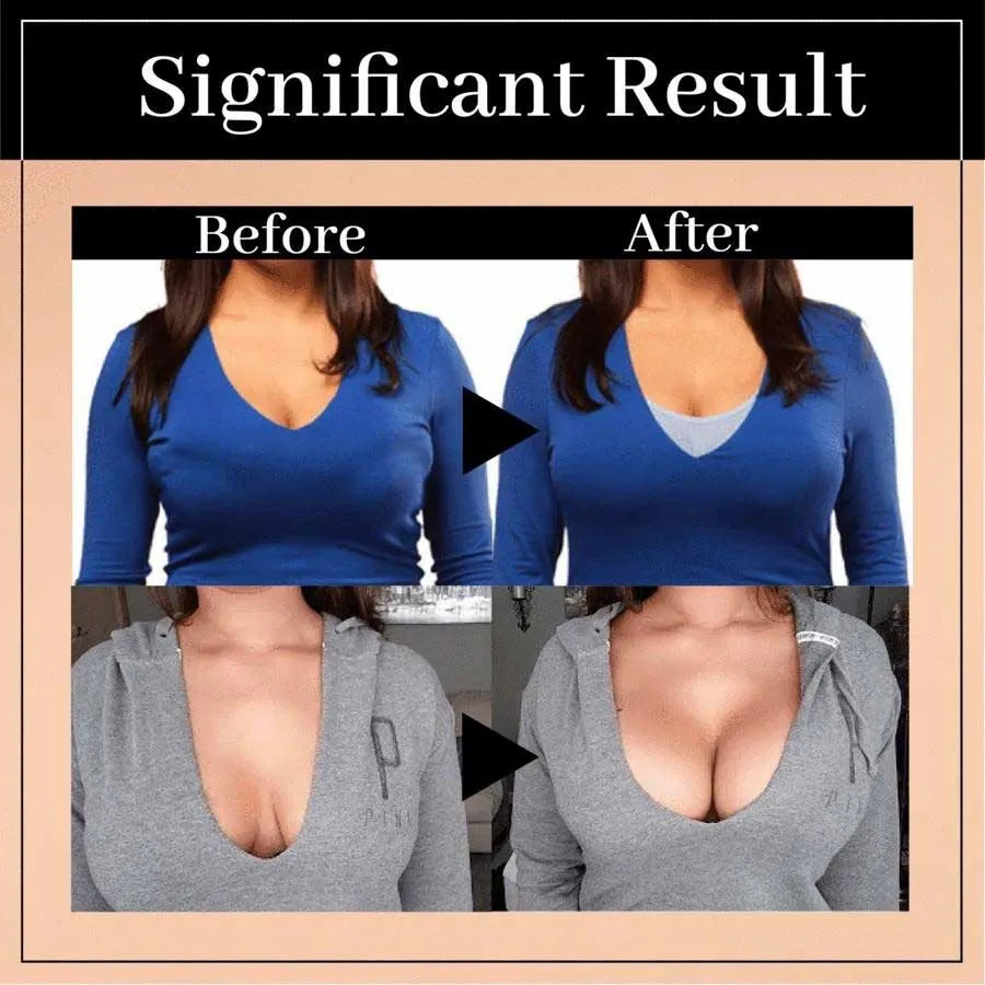 Sylis | Wireless Lift Up Posture Bra